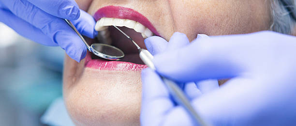 Best Emergency Treatment for Dental Infections or Abscesses in Cape Charles, VA